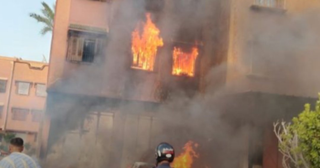 مصر طفل حرقا بنار اضرمها والده في منزل الأسرة