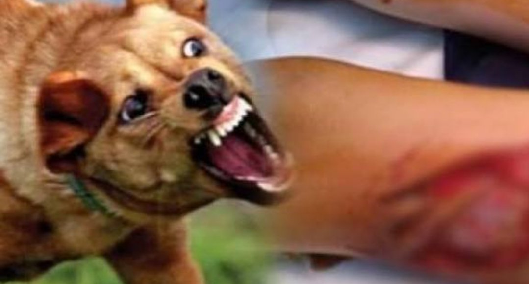 اب يقدم شكاية للدرك الملكي بتمنار بعد تعرض طفلته  لعضة كلب ضال